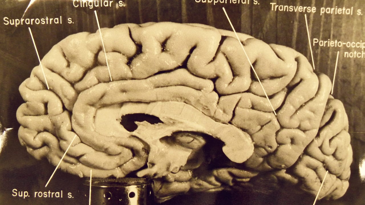 How Einstein S Brain Was Probably Different Than Yours And Why He Was