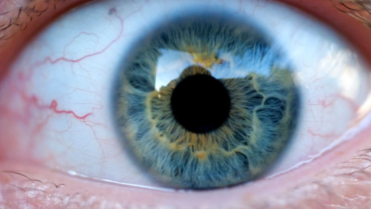 Smartphones Are Being Turned Into Cheap Portable EyeExam Kits