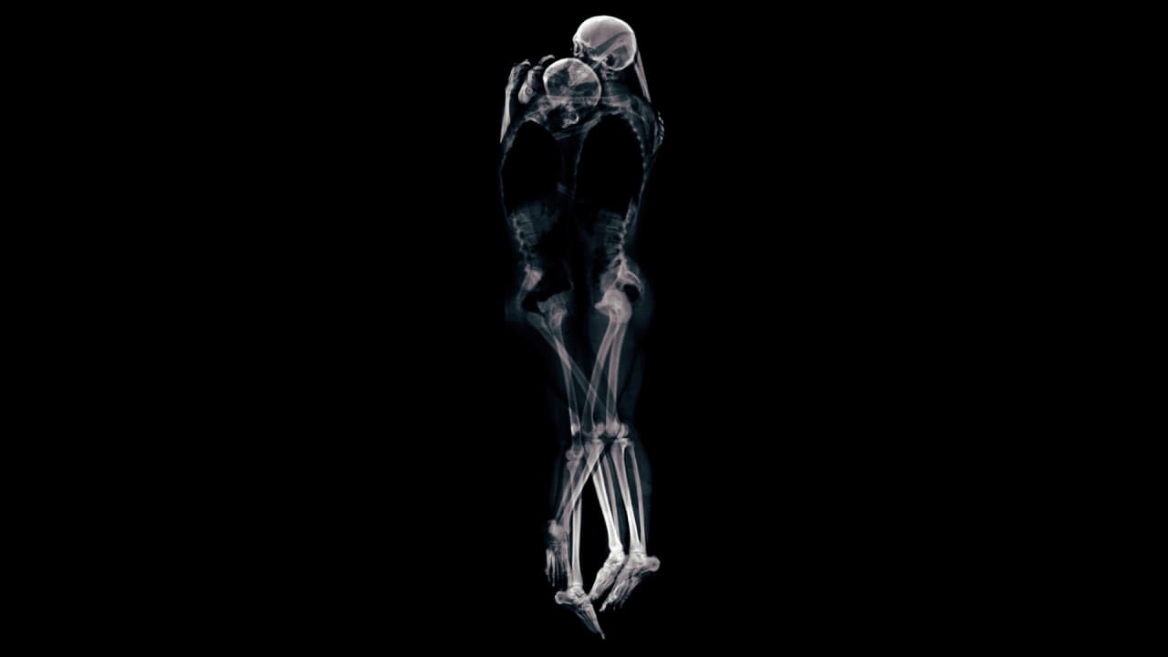 Download X-Ray Photos Show What Love Looks Like Beneath the Skin
