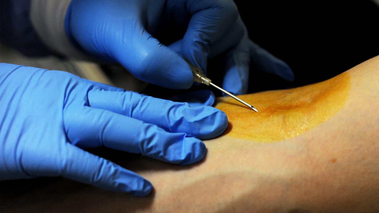 A Device That Could End Your Fear Of Needles