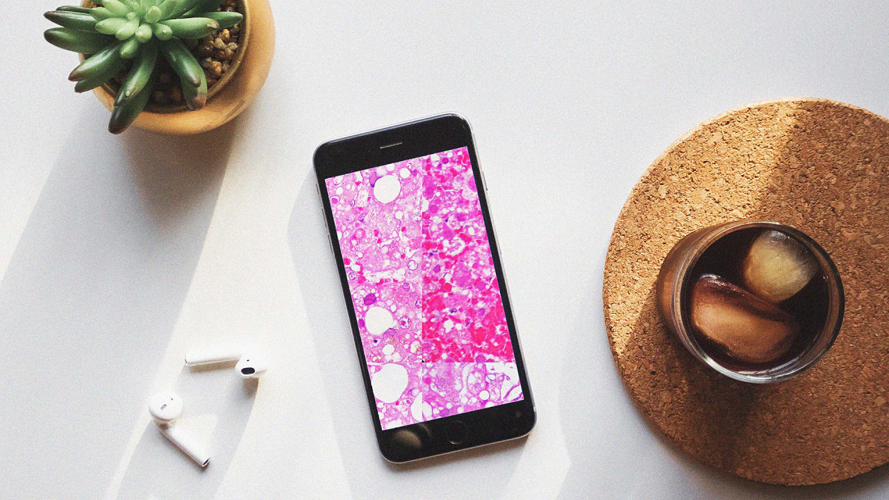 Unprecedented Android Spyware Designed To Listen In At Selected Places