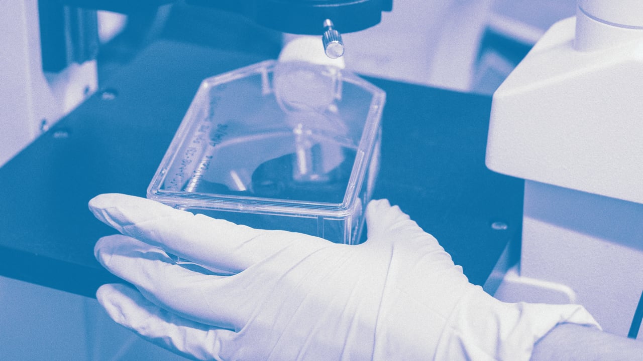 Candida auris CDC maps show mysterious fungus spreading in states and