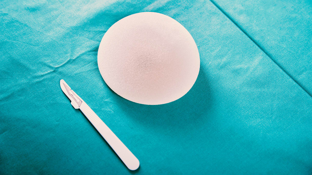 Allergan Breast Implants Recalled After Fda Links To Cancer Allergan Breast Implants Recalled After Fda Links To Cancer