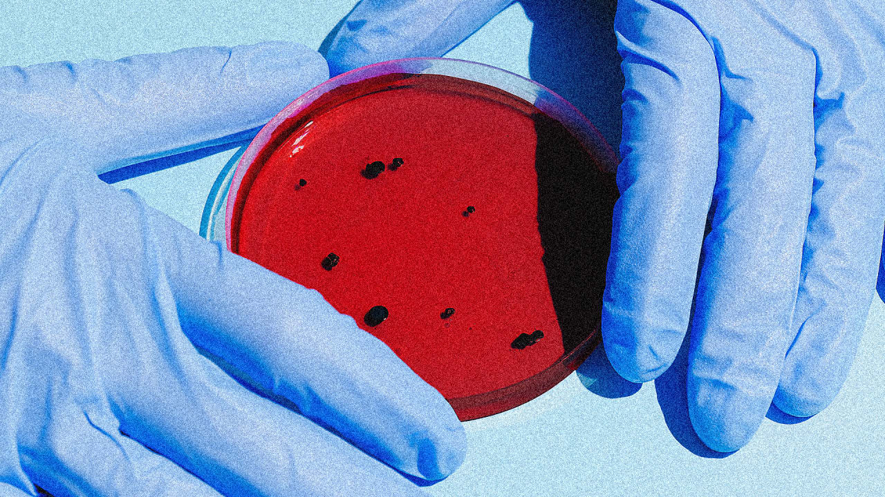 Salmonella outbreak This CDC map shows where it
