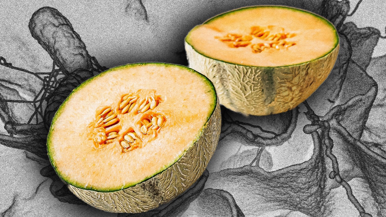 Cantaloupe Recall Salmonella Outbreak Leaves Dozens Ill Or Hospitaliz
