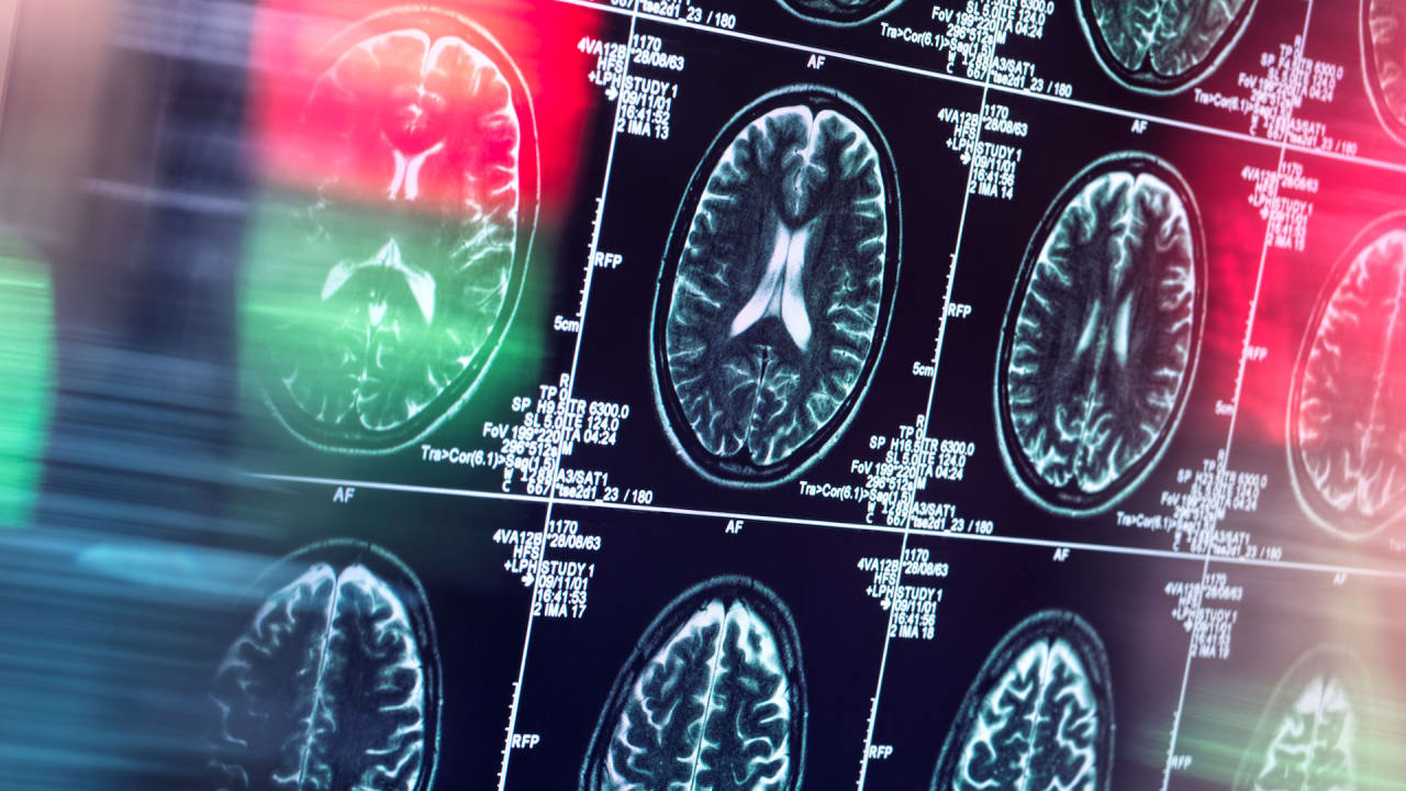 Do you believe in ghosts? Brain might be wired differently
