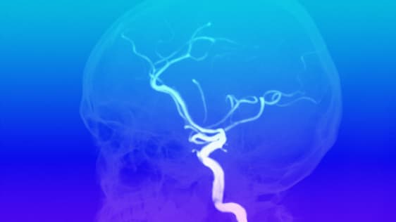 Soon you’ll be able to easily screen your brain for abnormalities—but should you?