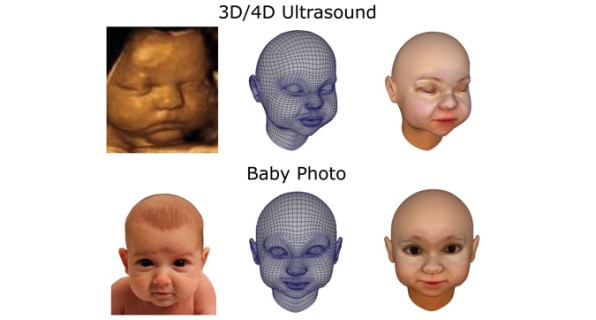 It Is Now Possible To 3-D Print Your Unborn Fetus