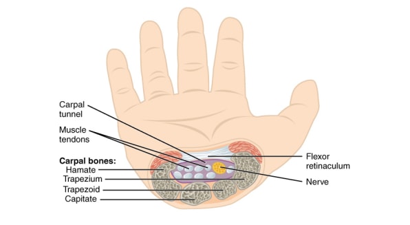 Carpal tunnel surgery - Wikipedia