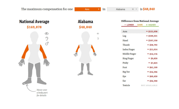 Missouri Work Comp Body Chart