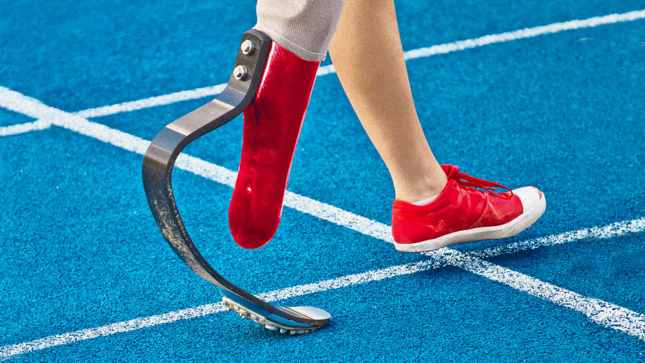 https://www.fastcompany.com/90532319/why-people-should-stop-designing-prosthetics-that-look-realistic-and-start-designing-ones-that-work