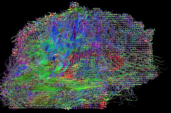 8 Mind-Blowing Images Of The Brain At Work